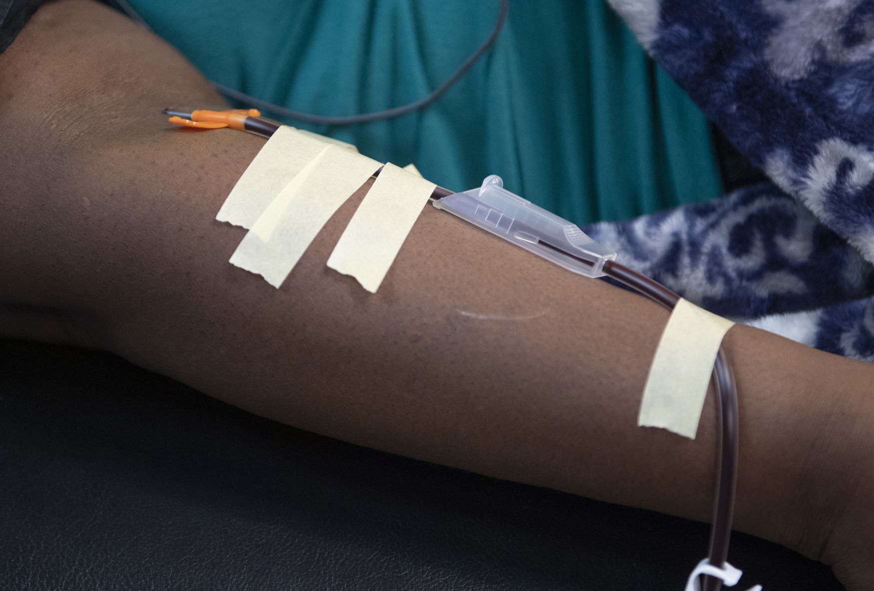 Plasma Donation